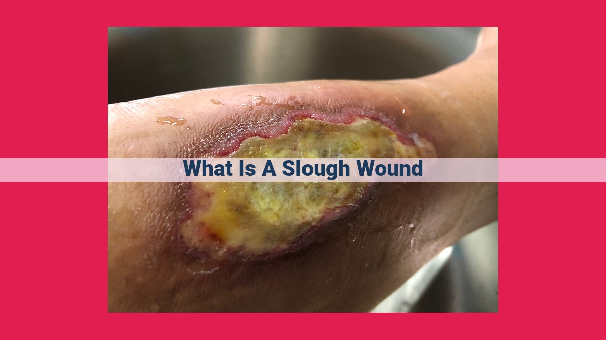 what is a slough wound