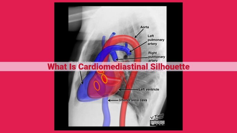 what is cardiomediastinal silhouette